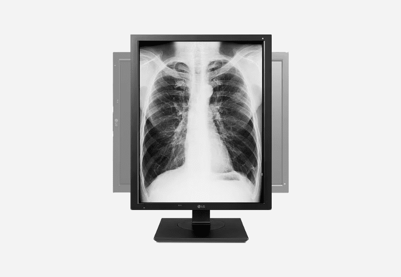 item-Monitor Médico LG de 3 MP - 21