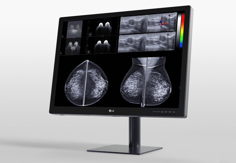 item-Monitor de diagnÃ³stico IPS LG 31