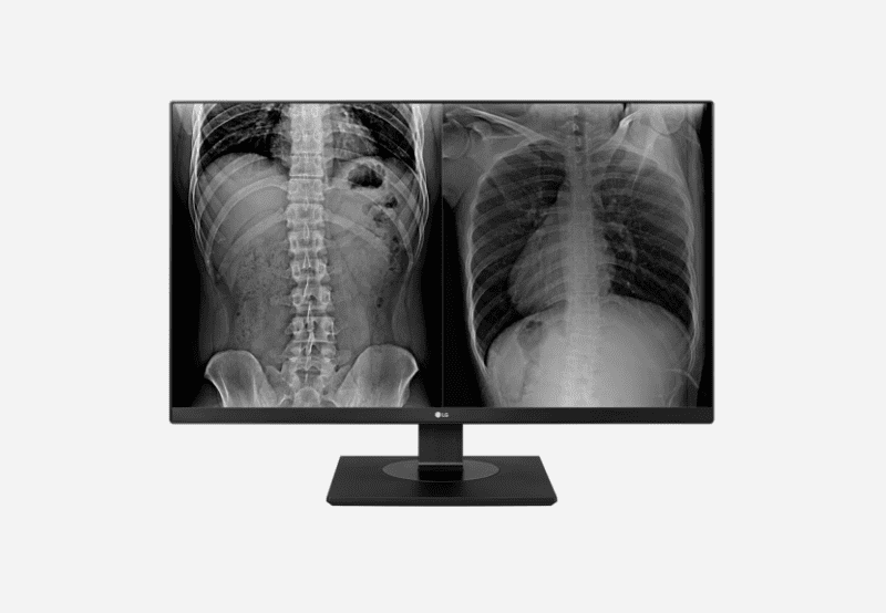 item-Monitor MÃ©dico LG - 27