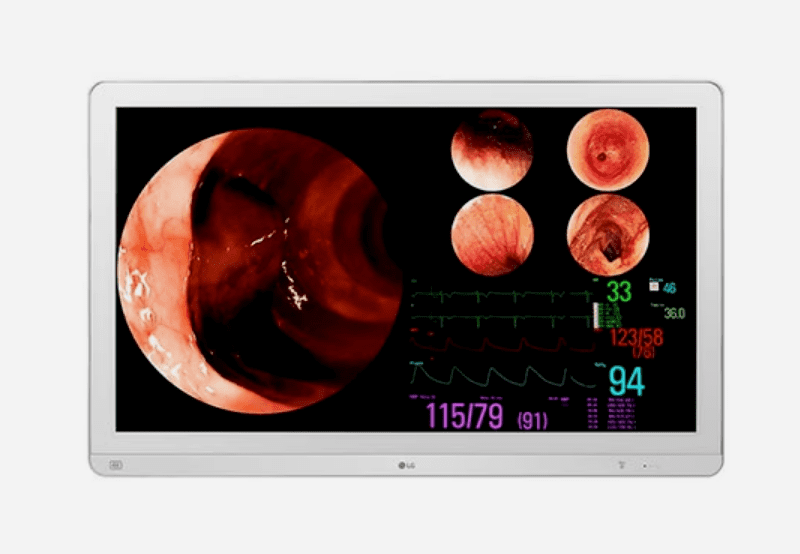 item-Monitor cirúrgico LG IPS 4K de 32